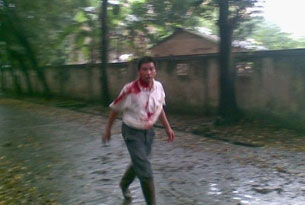 Beaten-Man-305 Beaten-Man-305